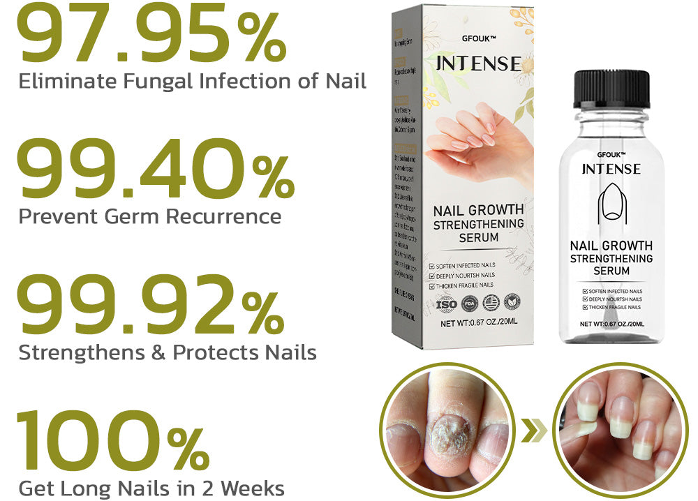 GFOUK™️ Intense Nail Growth and Strengthening Serum 