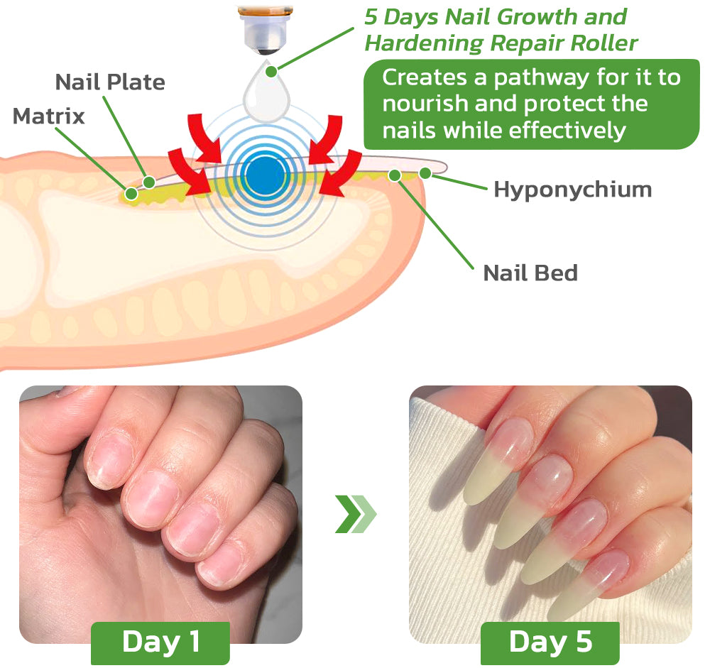 Sally Hansen - Sally Hansen, Grow Nails Now! - Vitamin Treatment, Growth,  Clear 3201 (0.45 oz) | Shop | Weis Markets