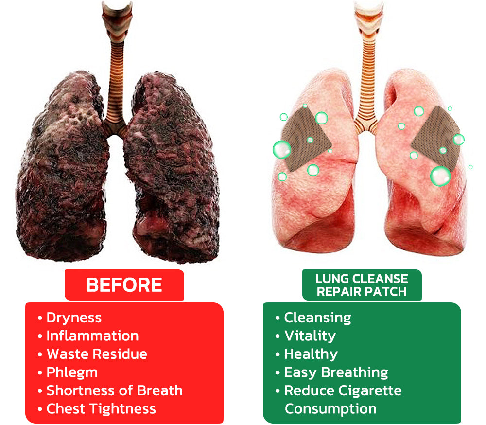 Croaie™ FreshAir Herbal Lung Cleanse Repair Patch