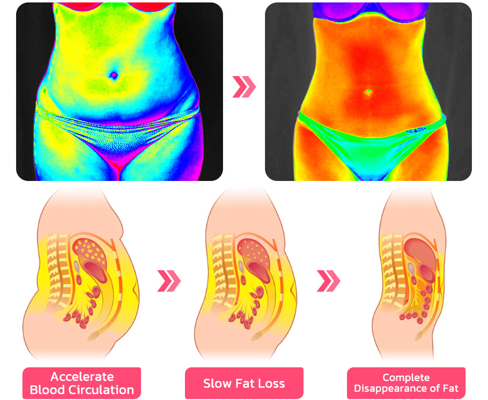  BOPBISGA Angelslim™ Negative Oxygen Ion Fat Burning