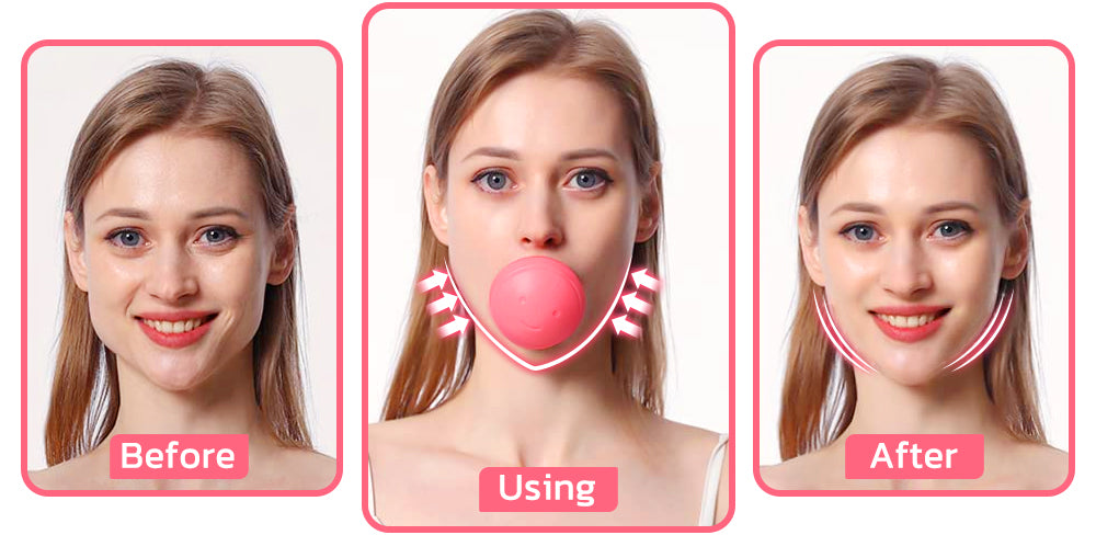 flysmus™ V Gesichtsabsaugung Beauty Trainer