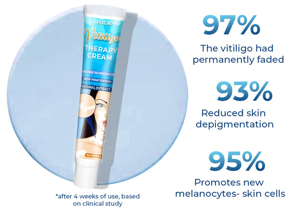 GFOUK™ Vitiligo Therapy Cream