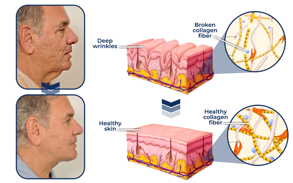 flysmus™ Men's AgeRevive Collagen Cream
