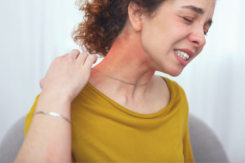 Woman showing symptoms of a metal allergy