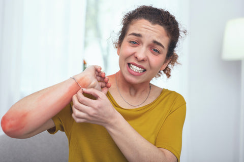 Woman showing symptoms of a metal allergy