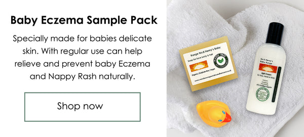 Baby Eczema treatment