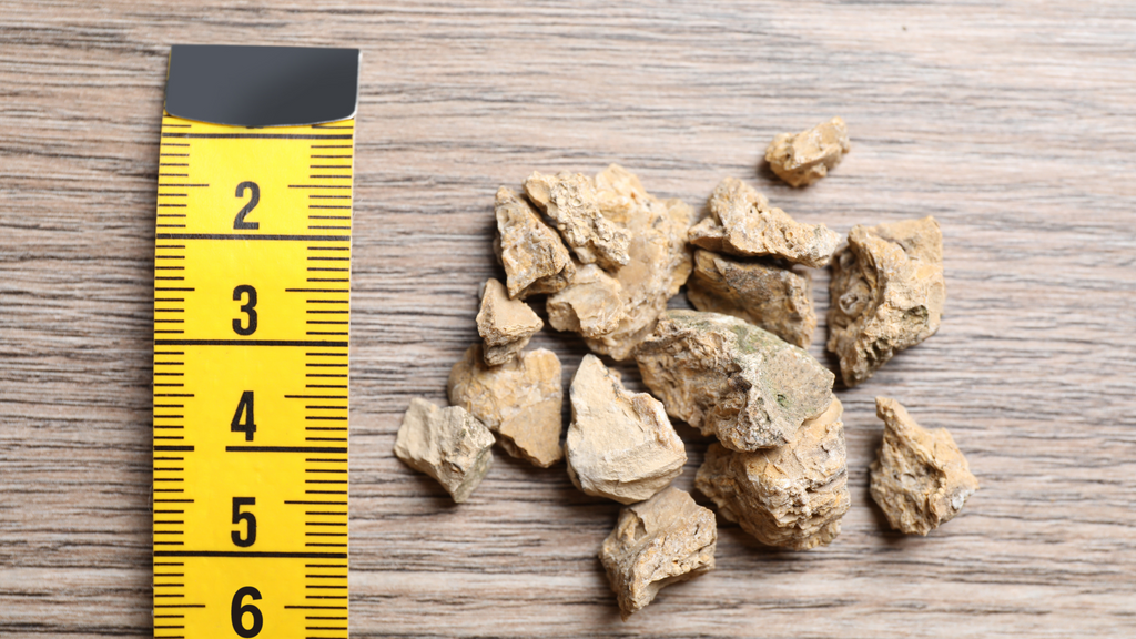 Pile of Kidney Stones and Measuring Tape on Wooden Table