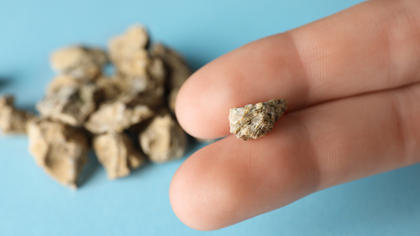 A person holding a kidney stone in their fingers