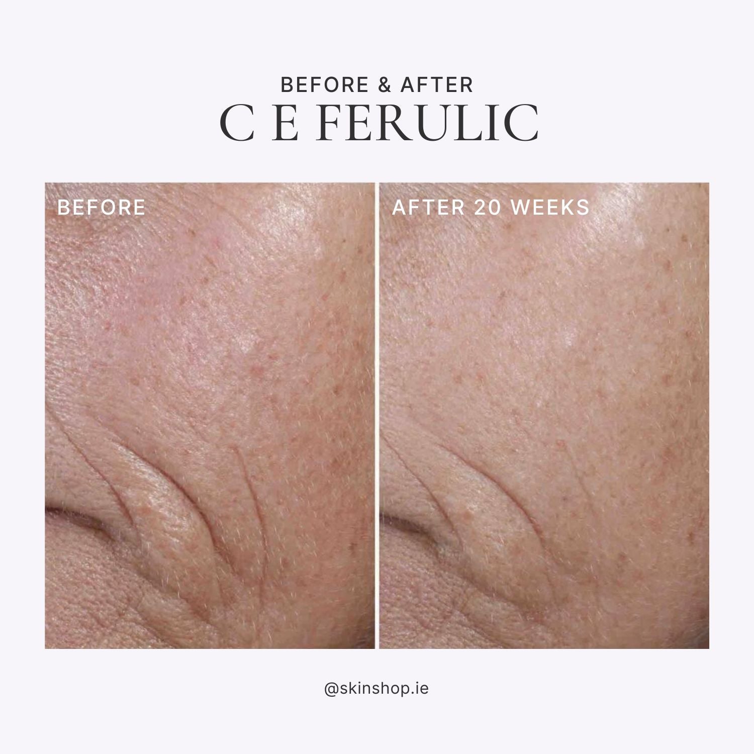 SkinCeuticals C E Ferulic Before & After