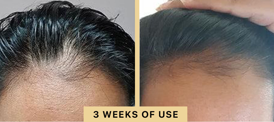 Back2Life Groluxe Advanced Hair Stimulation Oil Before & After Results 3 Weeks of Use
