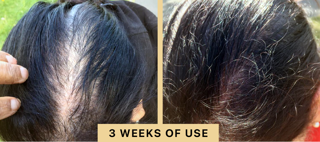 Back2Life Groluxe Advanced Hair Stimulation Oil Before & After Results 3 Weeks of Use