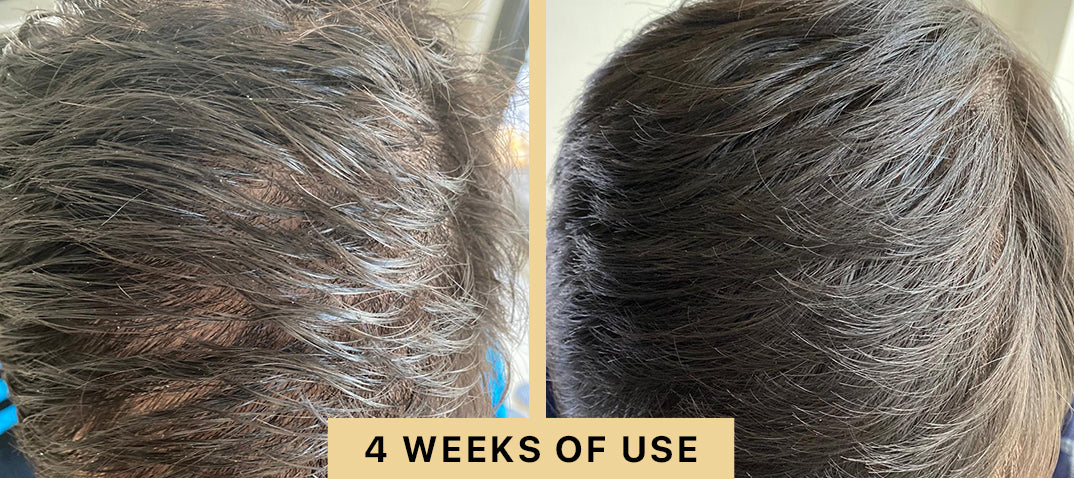 Back2Life Groluxe Advanced Hair Stimulation Oil Before & After Results 4 Weeks of Use