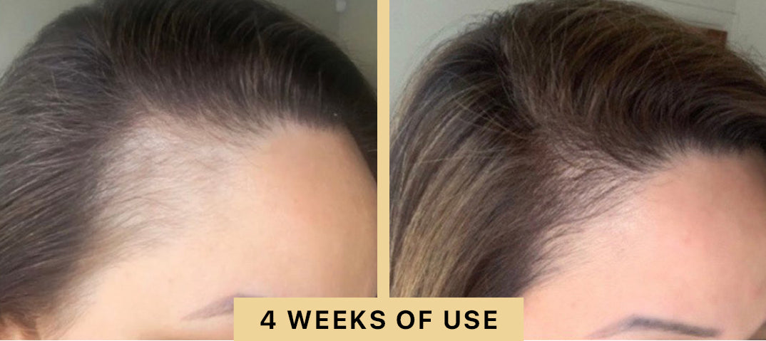 Back2Life Groluxe Advanced Hair Stimulation Oil Before & After Results 4 Weeks of Use