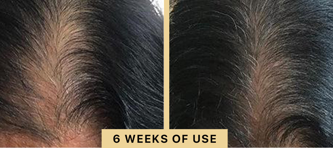 Back2Life Groluxe Advanced Hair Stimulation Oil Before & After Results 6 Weeks of Use