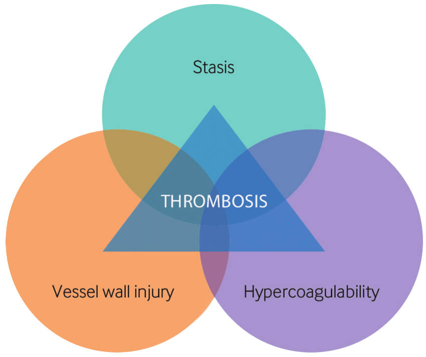 Virchow's Triad explains three main factors lead to blood clots