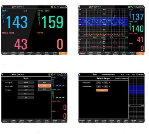 CARDIOTOCOGRAFO - Consegna entro 15/20 gg. – Lume Import Srl