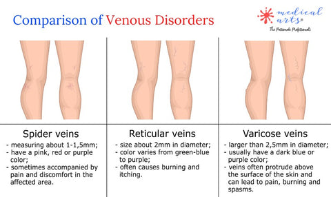 venous disorders medical arts shop