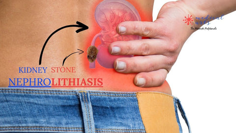 how to prevent kidney stones nephrolithiasis