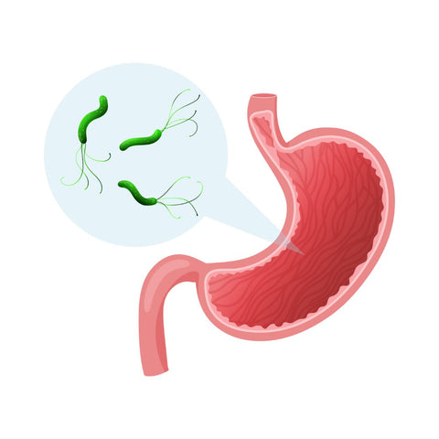 Stomach Ulcer ◑ Peptic Ulcer ● H.Pylori ◒ Medical Animations 3d ◐ Medical Arts