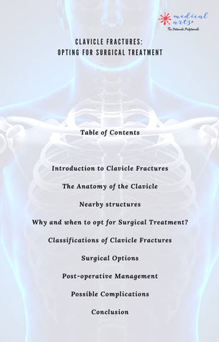 clavicle fractures, clavicle anatomy, illustrations