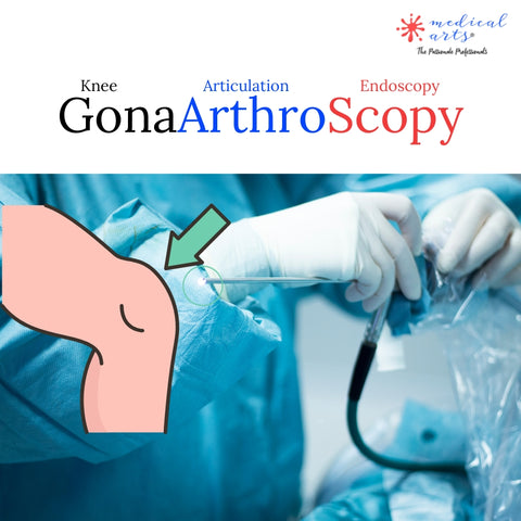 gonarthroscopy the endoscopy of the knee - ACL rupture and repair  (2)