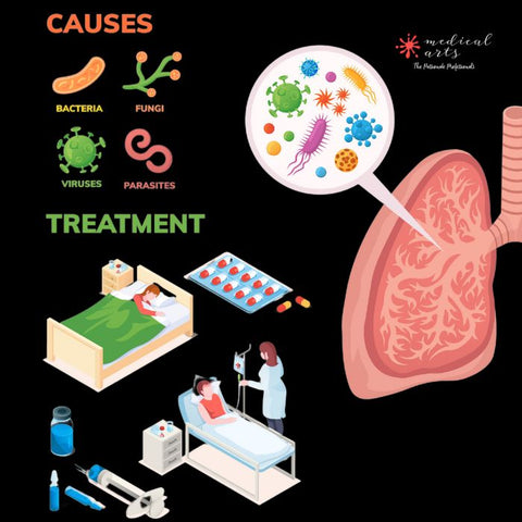 pneumonia causes and treatments