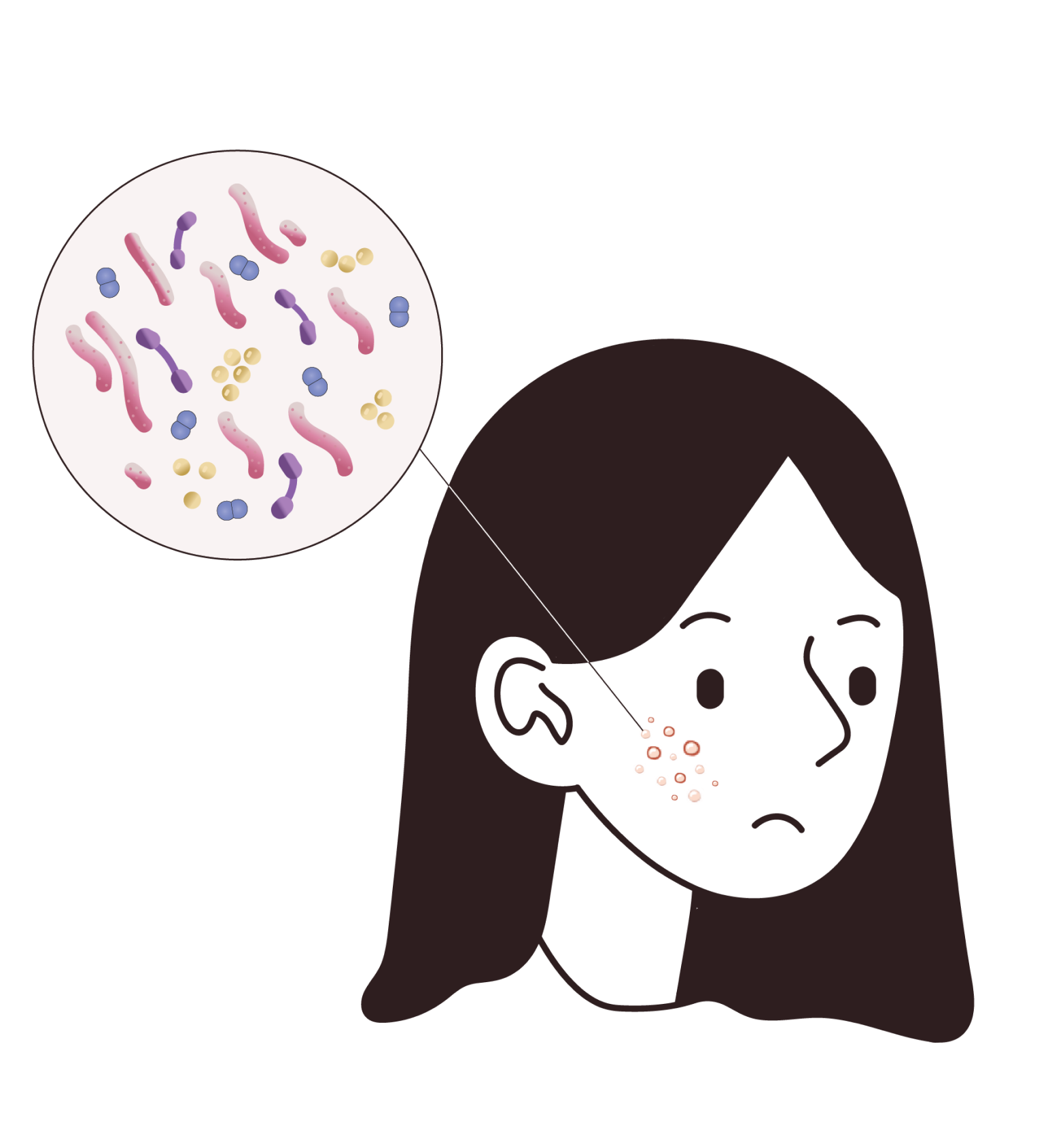 Illustration of Sad Woman With Acne