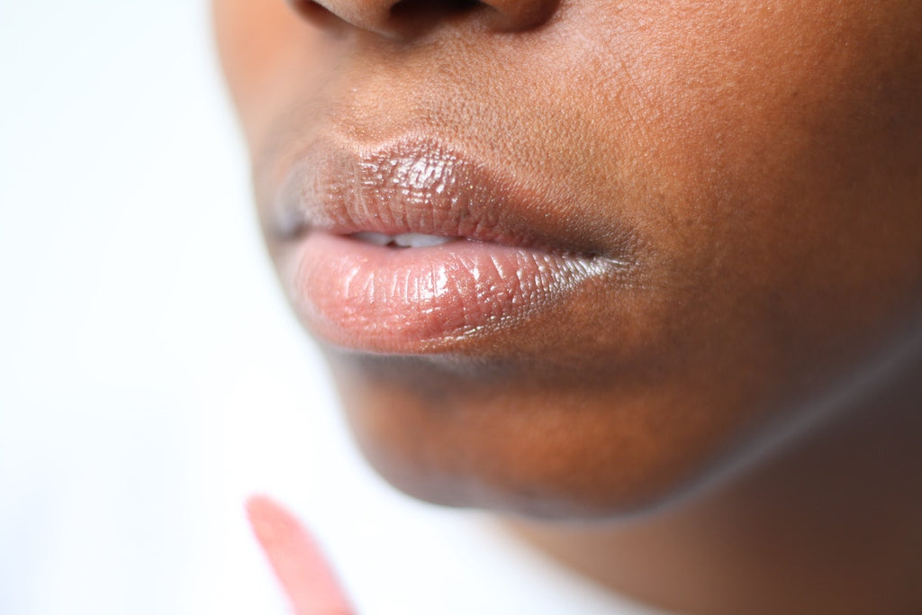 dry lips causes