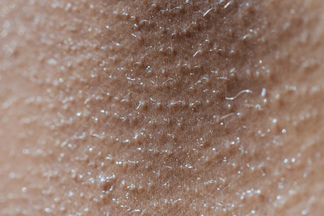 Close-up photo of woman skin, highlighting its texture and details