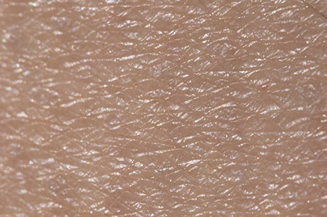 Dry Caucasian skin texture photo, displaying the effects of dryness and dehydration