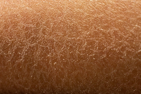 Woman's dry skin picture on her leg with detail view