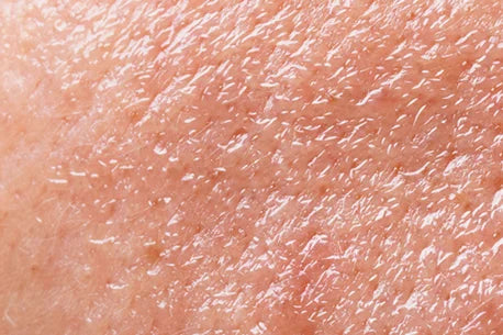 Closeup picture of human oily skin as a textured background