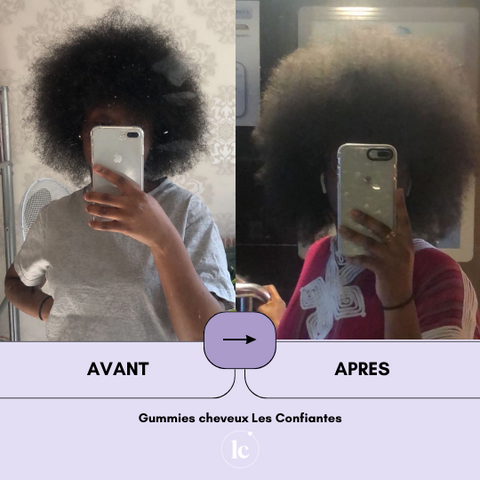 gummies cheveux avant après