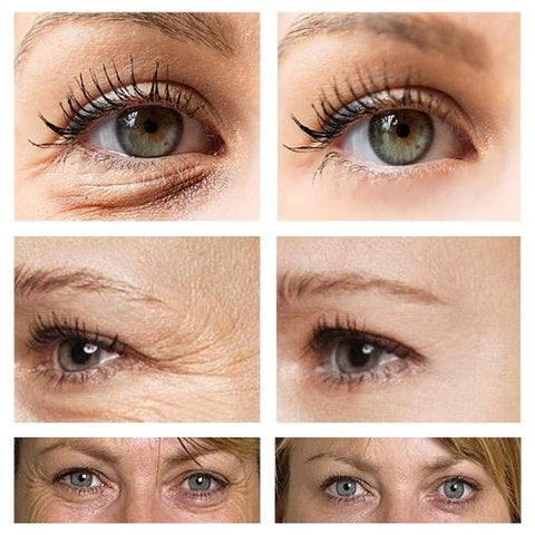 Seis colagens de olhos de mulheres que utilizaram o Creme YOUNGCÖME Original, mostrando o antes e o depois do uso, com resultados significantes em sua pele.