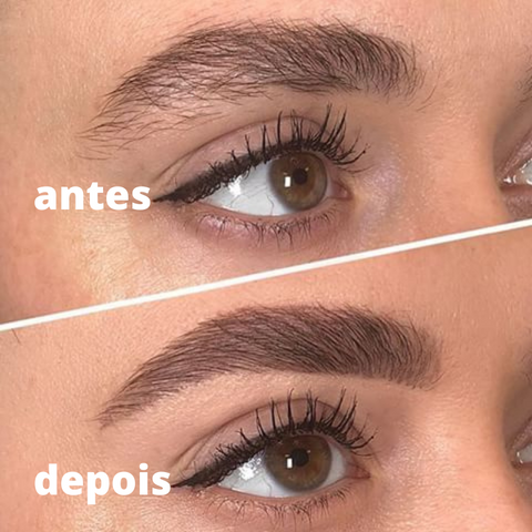 Antes e Depois