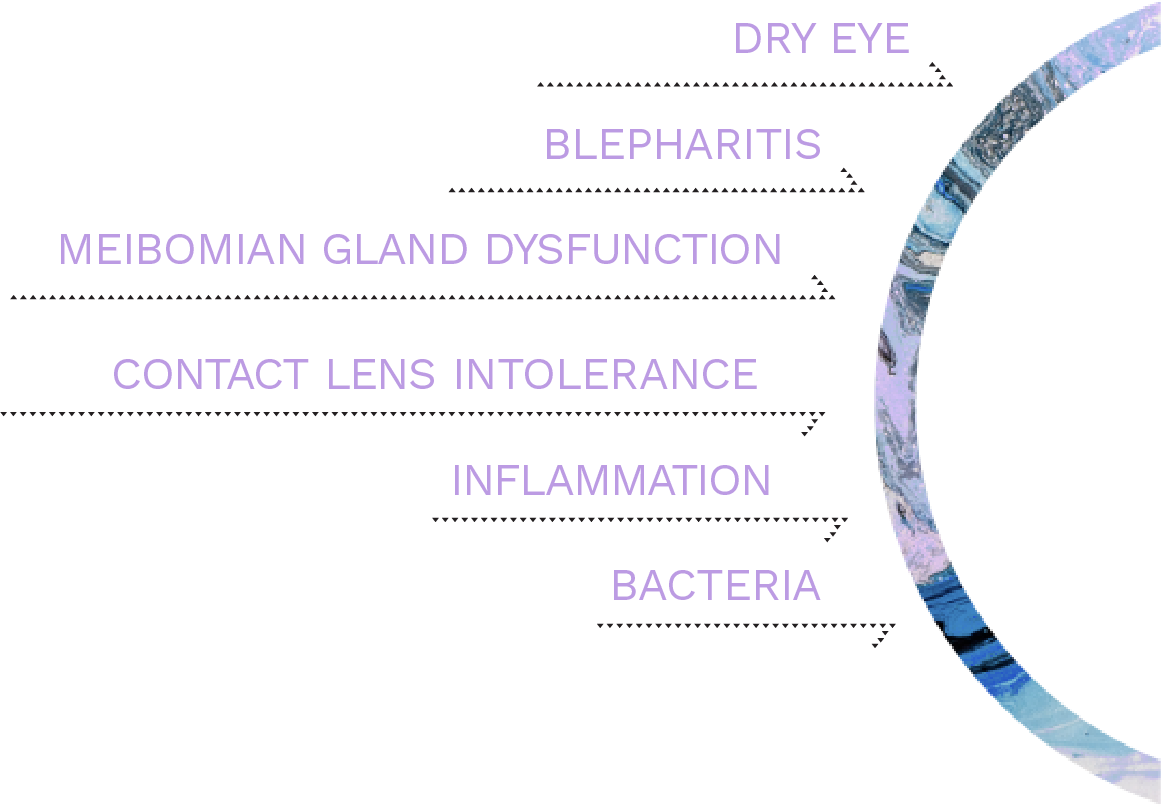 List of chronic eye conditions