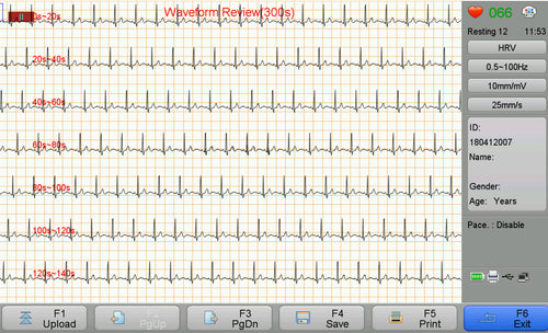 HRV waveform acquisition