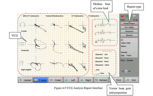 VCG-analysis-report