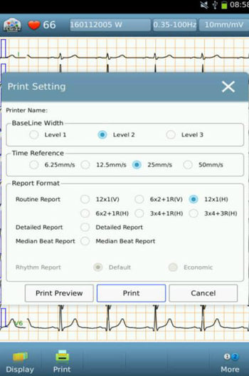 iE10 ecg machine print setting