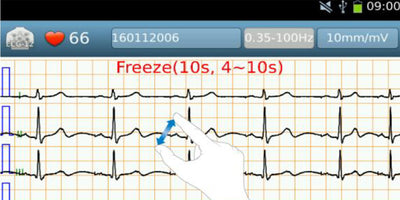 iE10 ekg machine gesture operation pinch