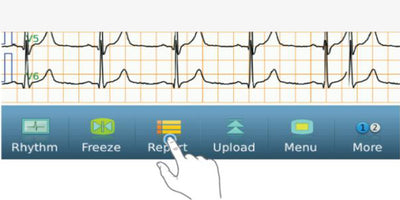 iE10 ekg machine gesture operation tap