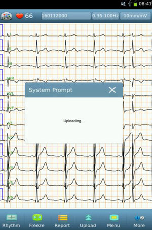 standard 12-lead ecg data upload