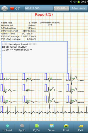 standard 12-lead ecg report I