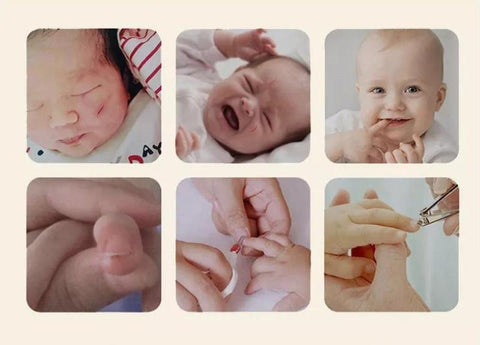 Como prevenir marcas de unha no rosto do beb