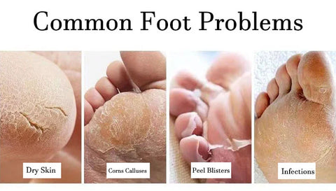 Feet Foot common disease problems usa uk