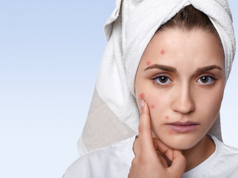 what causes dark spots on face