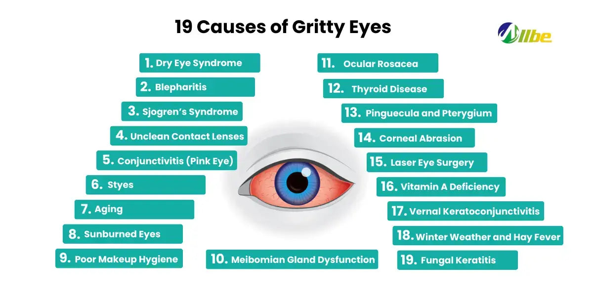 19 gritty eyes causes