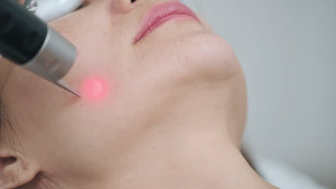 Rosacea and light therapy