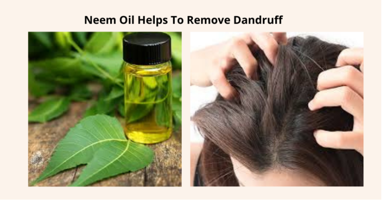 7 Amazing Benefits Of Neem Oil For Common Hair Problems – Krishna's ...