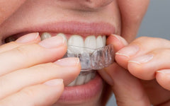 a lady biting into a retainer